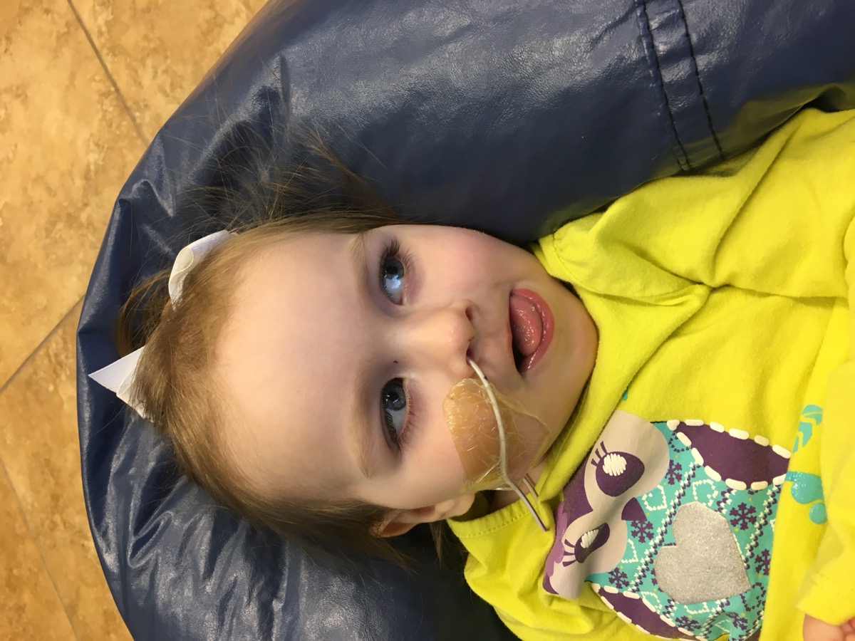 Sophia with her NG tube in March 2017, shortly before G-tube placement